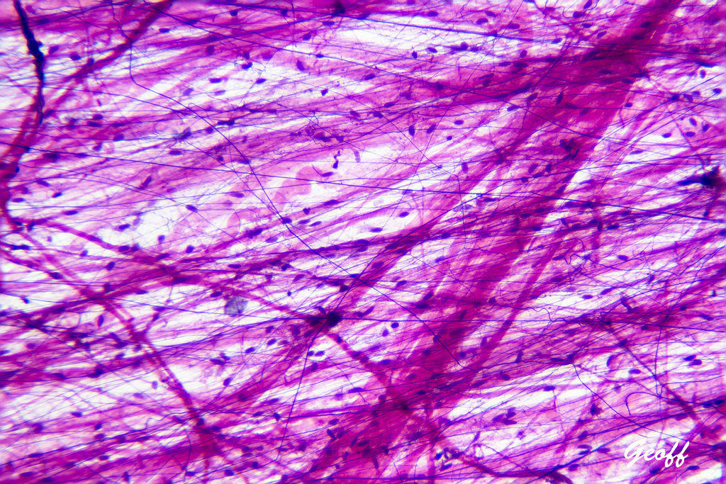 <p>Loose connective areolar, adipose, or reticular?</p>