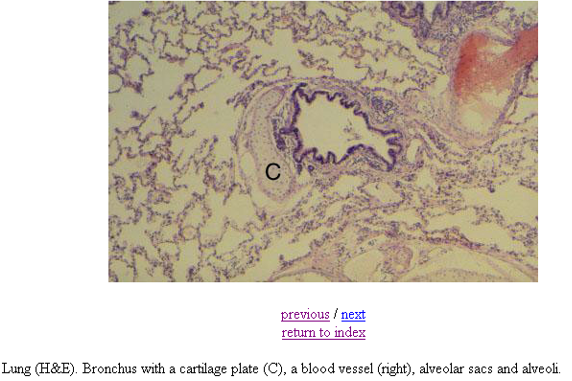 <p><strong>Bronchus</strong></p><p><em>Has cartilage. Bronchioles will not have cartilage</em></p>