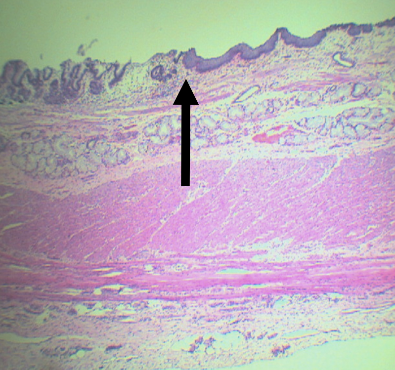 <p>Lining epithelium of the right side of this structure</p>