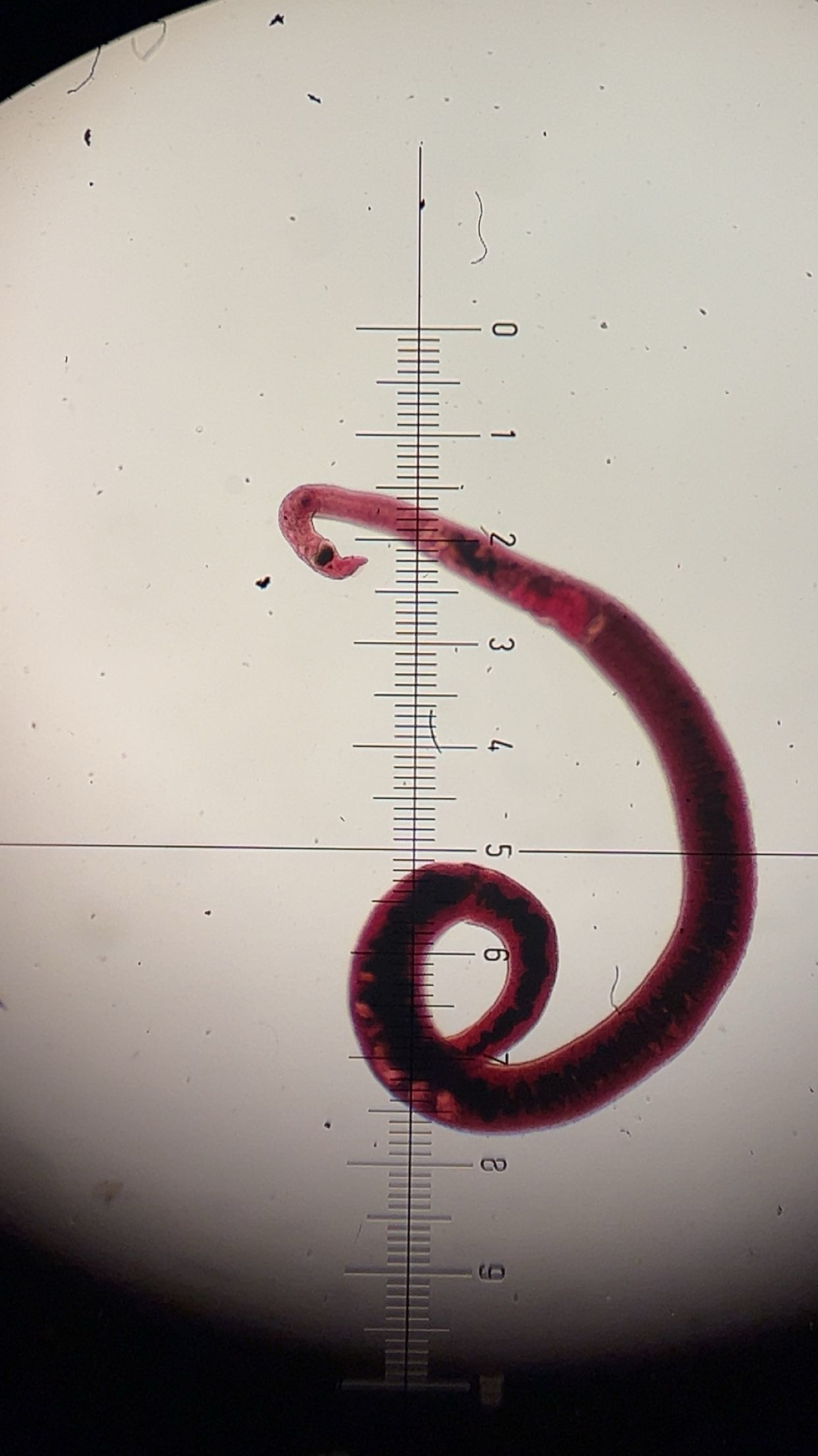 <p><em><span>Schistosoma mansoni </span></em><span>adult female</span></p>
