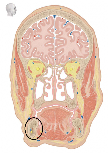 term image