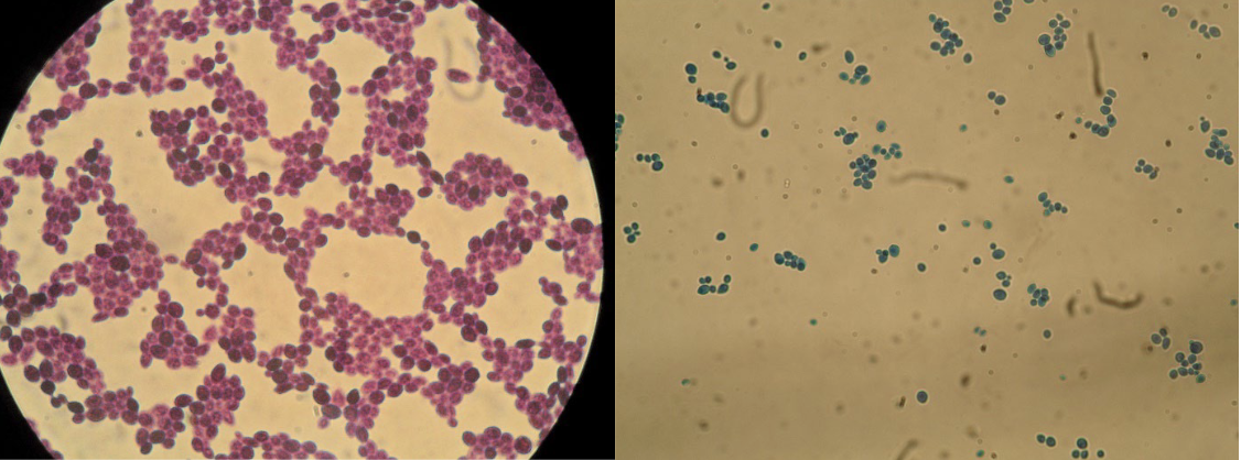ex) yeast

Yeast reproduce asexually by budding. Yeast also reproduce sexually by forming an ascus and eight ascospores.