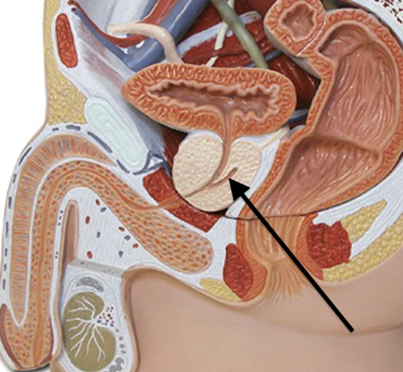 <p>seminal vesicle duct joins with ductus deferens</p>