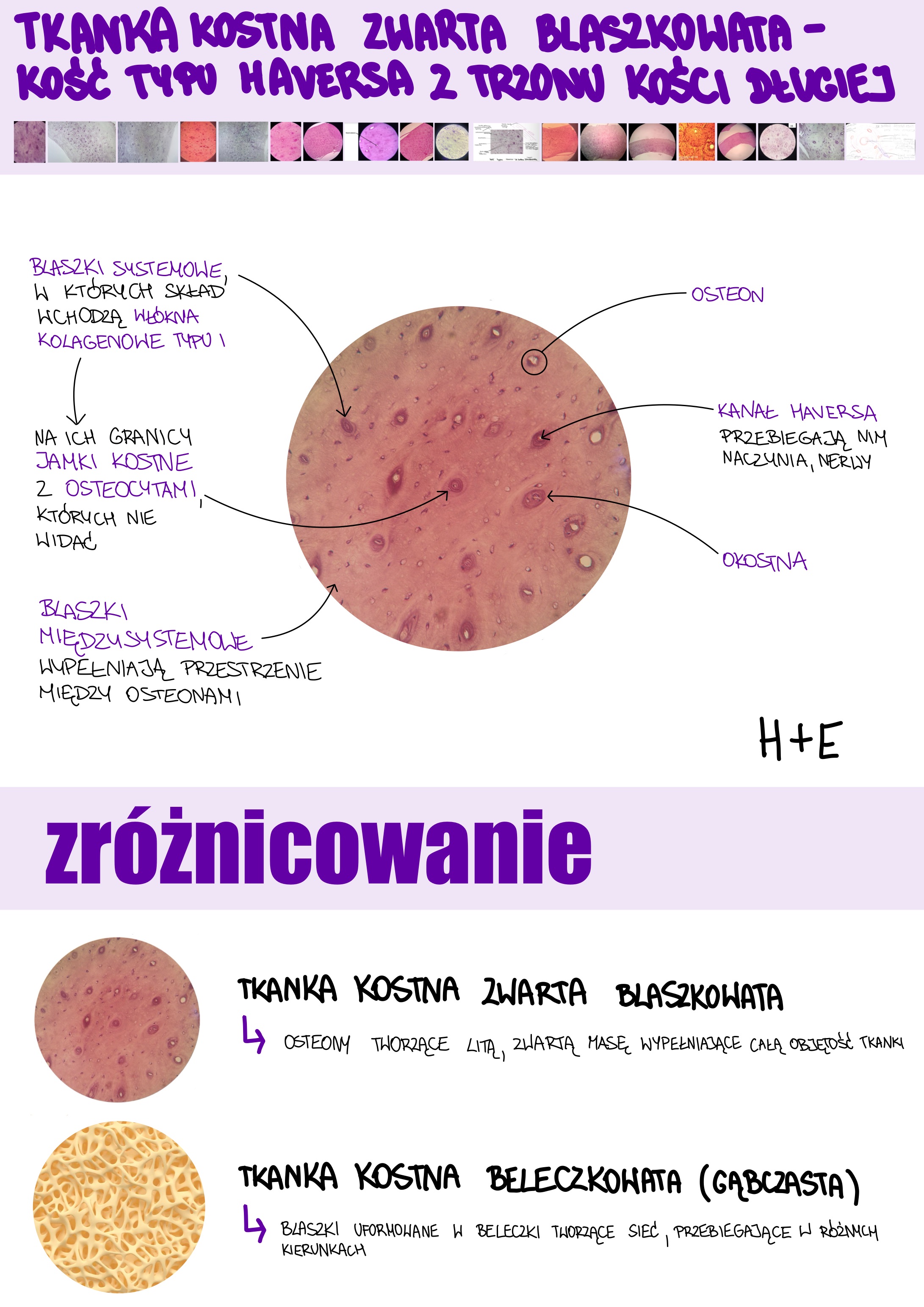 <p>Tkanka kostna zwarta blaszkowata - kość typu Haversa z trzonu kości długiej</p>