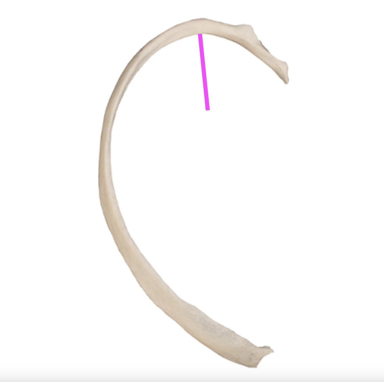 <p>What part of the rib is this?</p>