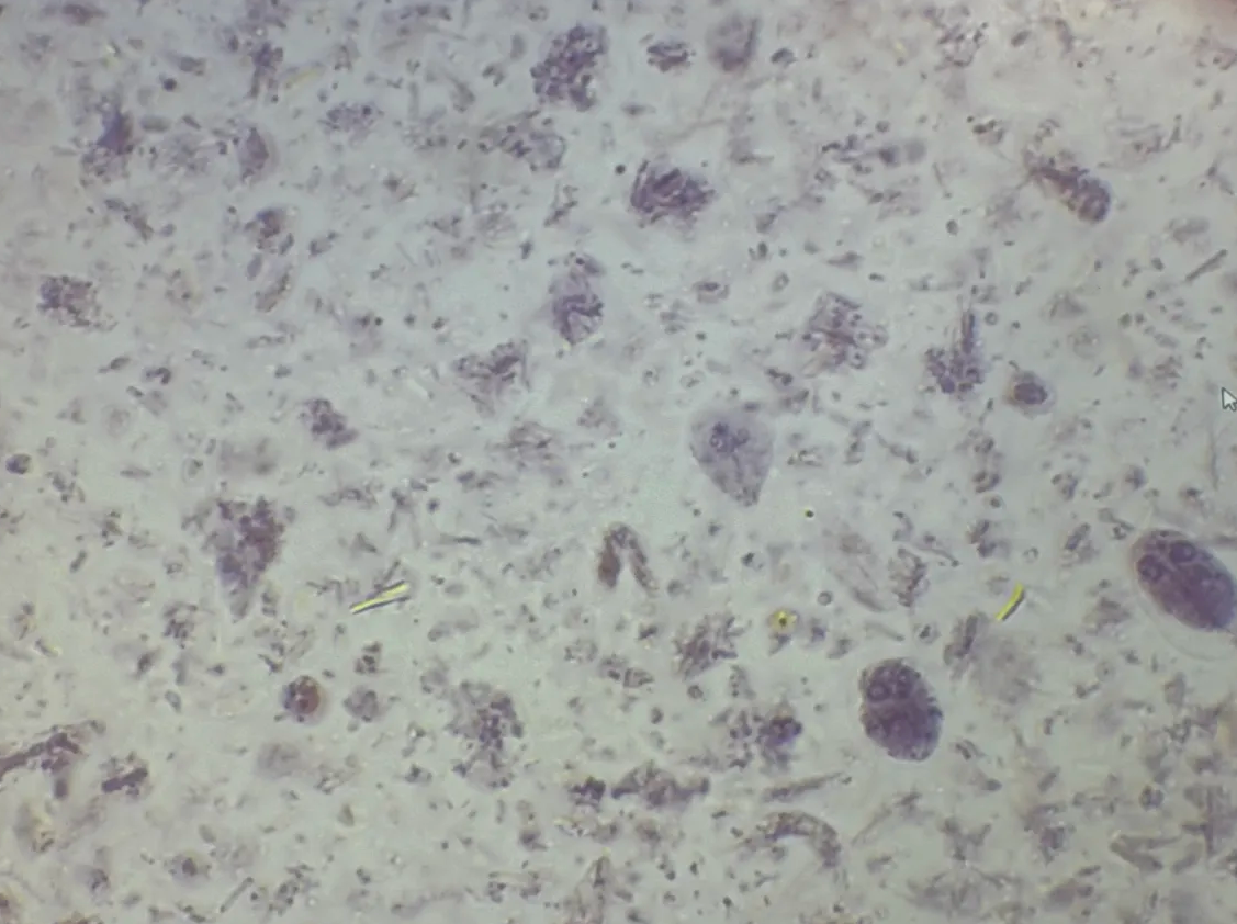 <p>in humans with generic GI problems</p>