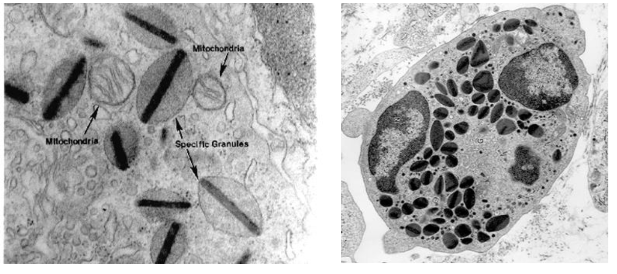 <p><span>What structures are labeled in this electron micrograph of an eosinophil?</span></p>
