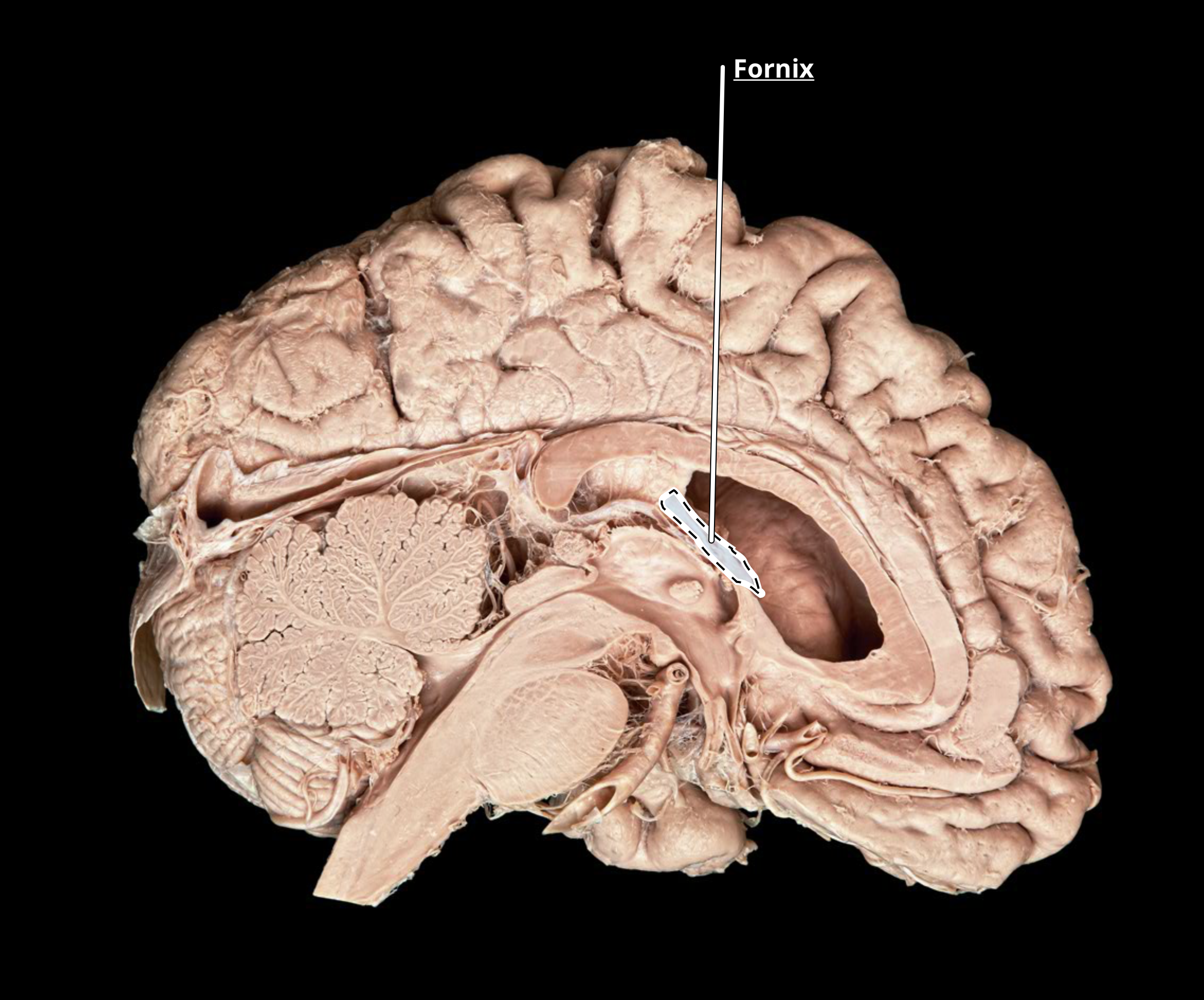 <p>fornix</p>