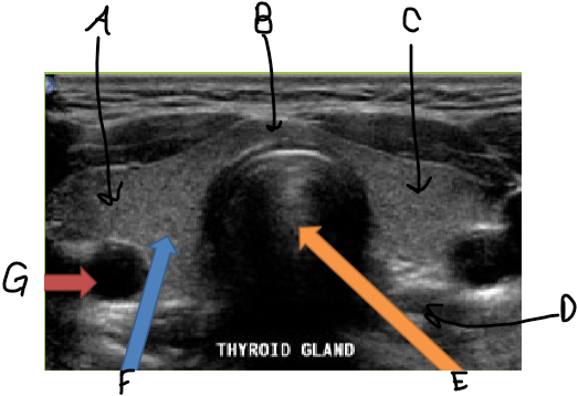 <p>Transverse thyroid image</p>