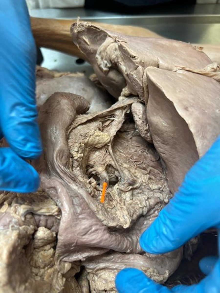 <p>splenic artery</p>