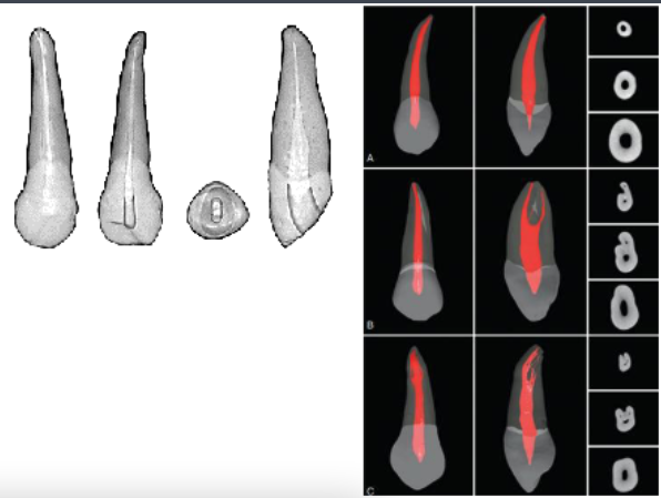 <p>1 pointed pulp horns</p><p>narrower MD than LL</p>
