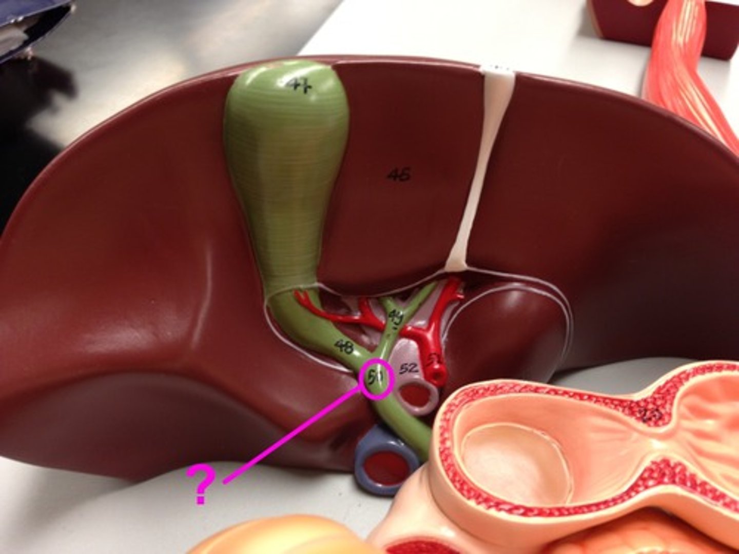 <p>A tube that carries bile from the liver and gallbladder to the intestine</p>