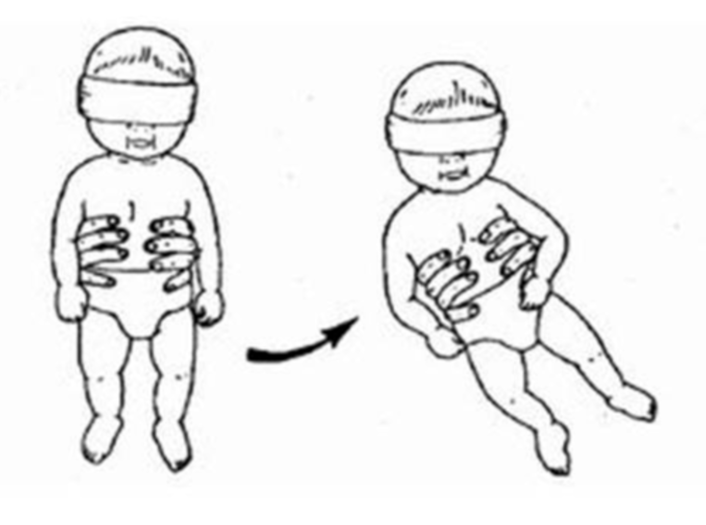 <p>tilt infant in vertical suspension with eyes covered</p><p>- baby should orient their head to vertical</p><p>- onset birth-2 months</p>