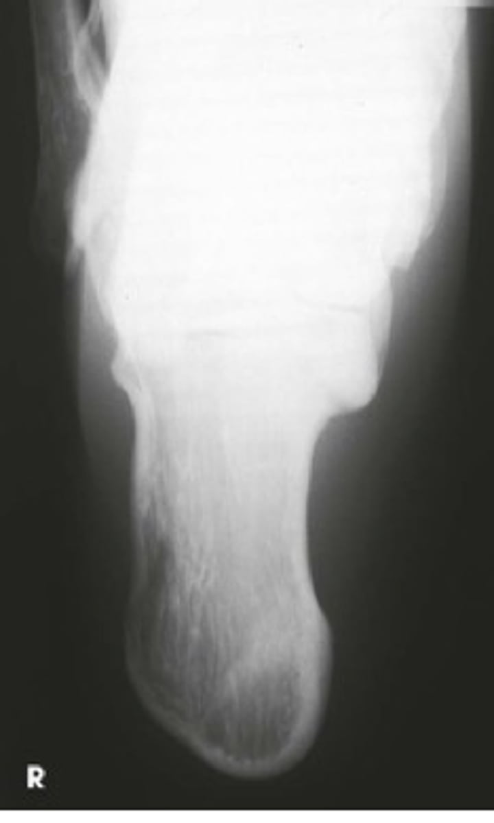 <p>-AP Towne Skull</p><p>-axial calcaneus</p>