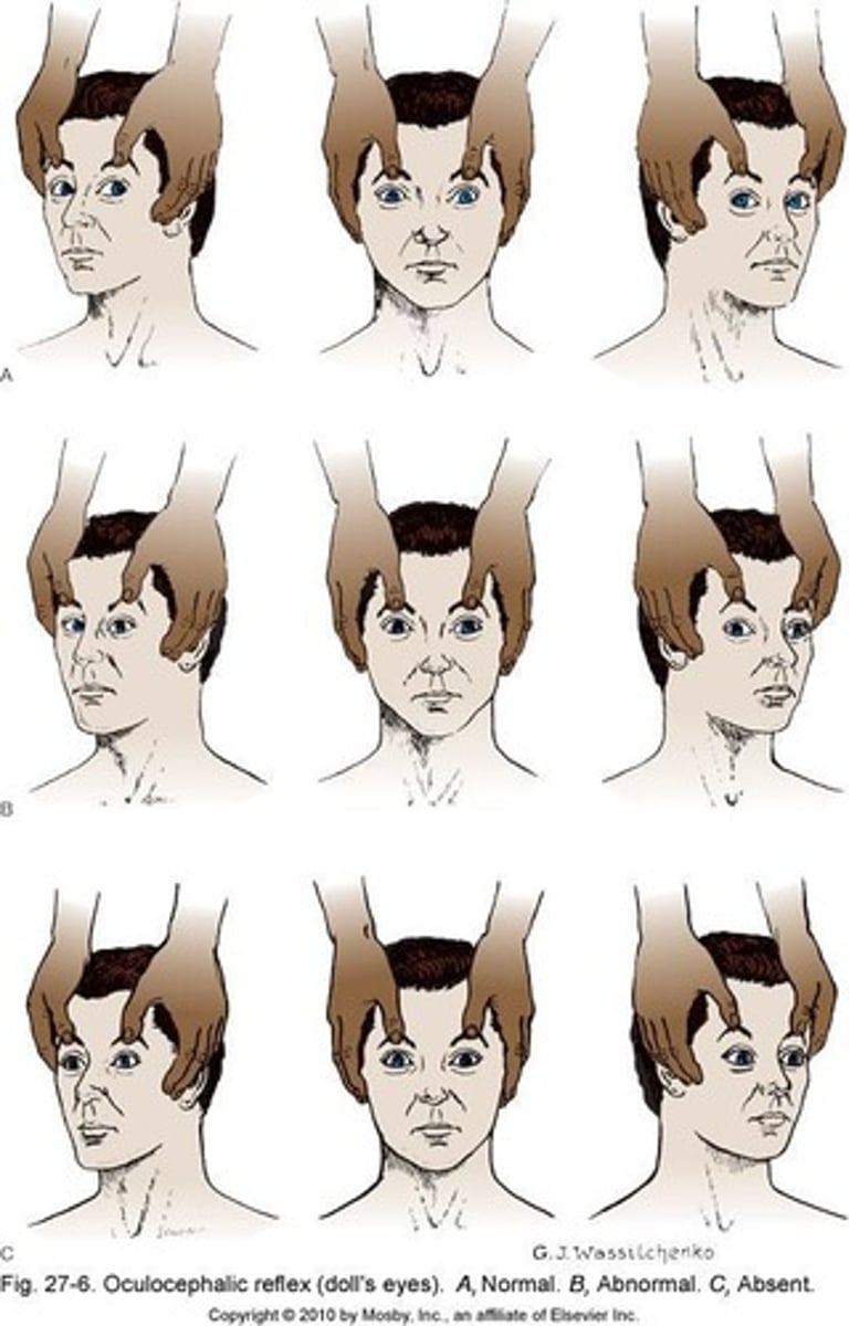<p>Controls eye movement and pupil response.</p>