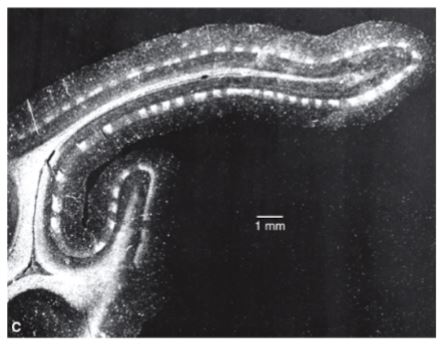 <p>what is illustrated in this photomicrograph?</p>