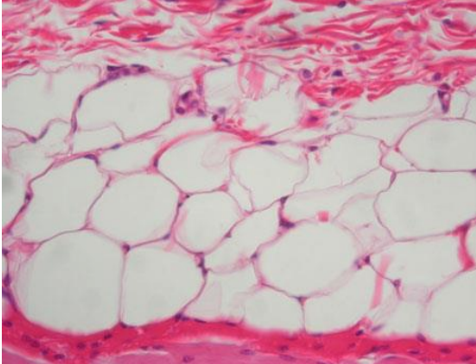 <p>adipose tissue</p>