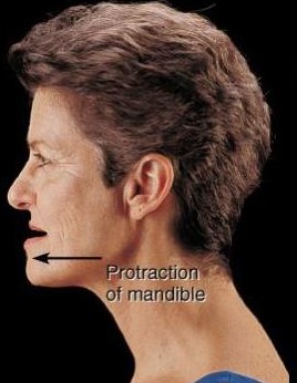 <p>Protraction </p>