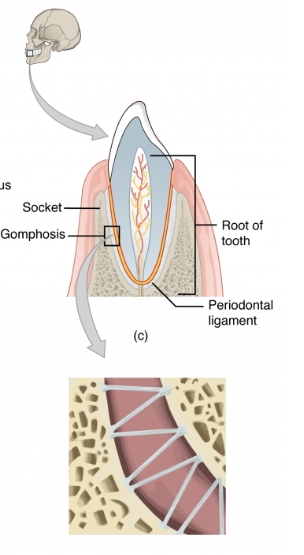 <p>a type of fibrous joint that anchors teeth to their sockets in the jawbone, allowing no movement. </p>