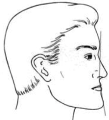 <p>what is this facial profile </p>