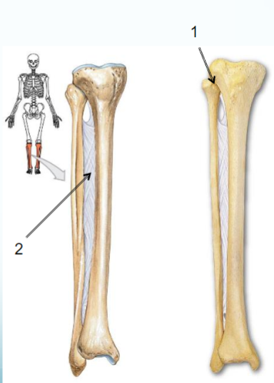 <p>Name joint 2.</p>