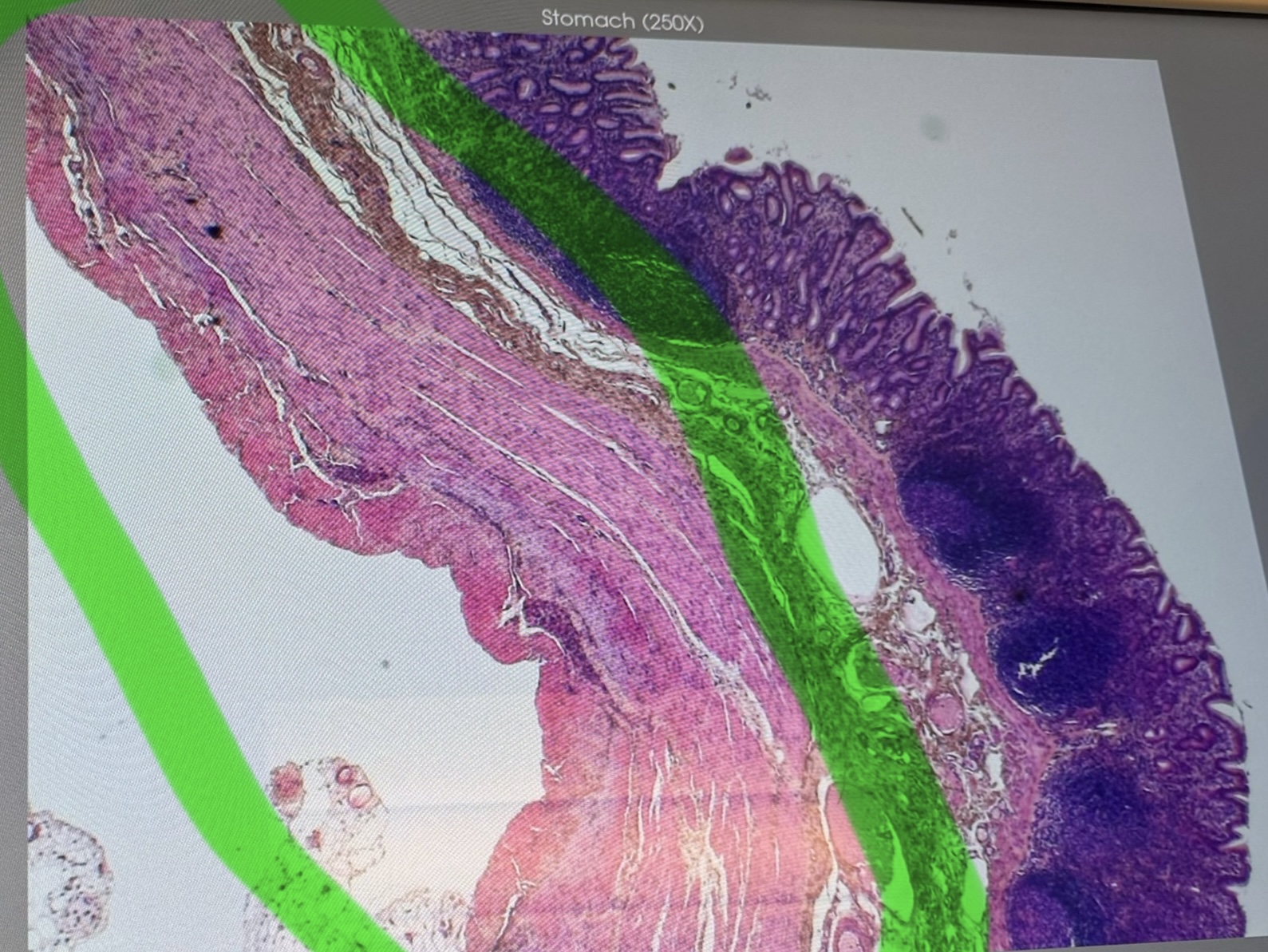 <p>Stomach (#10140): 3 layers of smooth muscle</p>