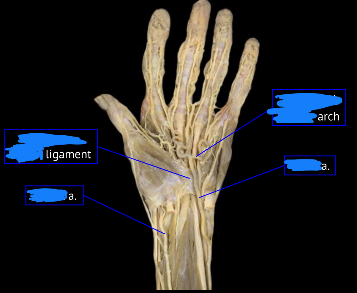 <p>left artery</p>