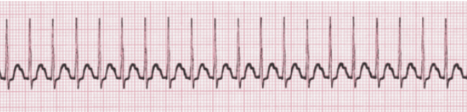 <p>Identify the rhythm! Discuss nursing and collaborative care</p>