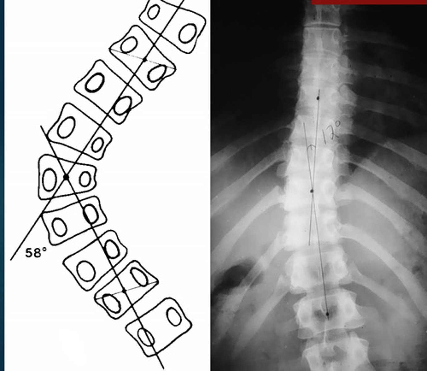 <p>What line of mensuration is this?</p>