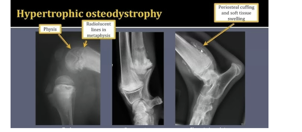 <p>How to diagnose HOD</p>