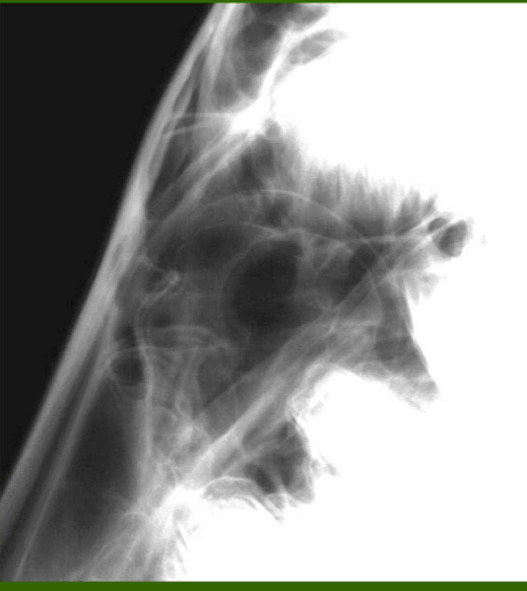 <p>Identify the pathology?</p>