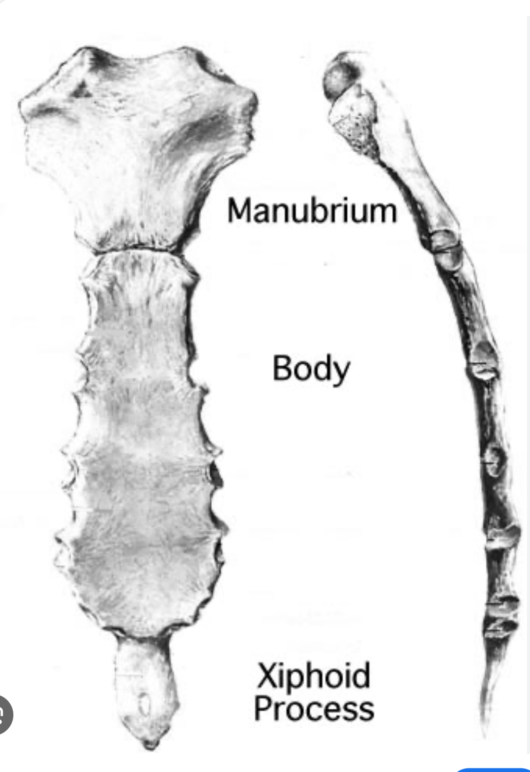 <p>Parts of breast bone/sternum</p>