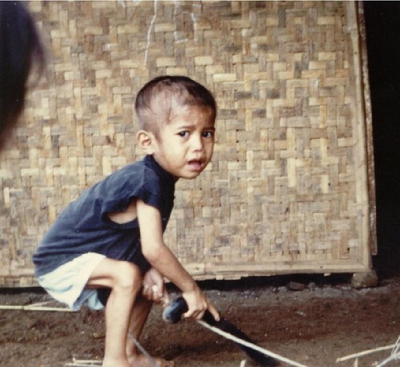 <p>sự suy dinh dưỡng</p>