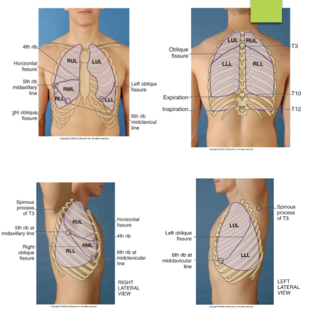 <ol><li><p>right upper lobe</p></li><li><p>horizontal fissures @ the 4th rib and 5th ribe at the midaxillary line</p></li><li><p>right middle lobe</p></li><li><p>left oblique (diagonal) fissures running from the T3 to the 6th rib midclavicular line (meet with the horizontal fissures at the 5th rib midaxillary line)</p></li><li><p>right lower lobe</p></li></ol><p></p>