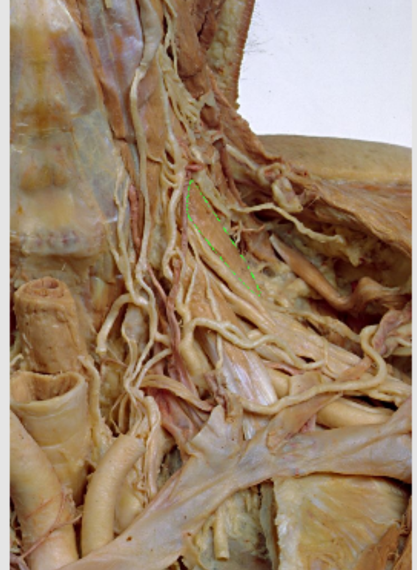 <p>What muscle</p>