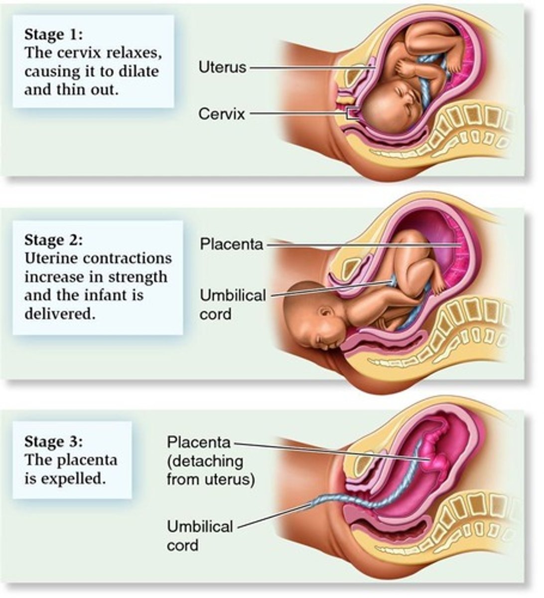 <p>1st Stage: Onset of contractions to full dilation; 2nd Stage: Dilation to birth; 3rd Stage: Birth to placenta delivery; 4th Stage: Recovery and bonding.</p>