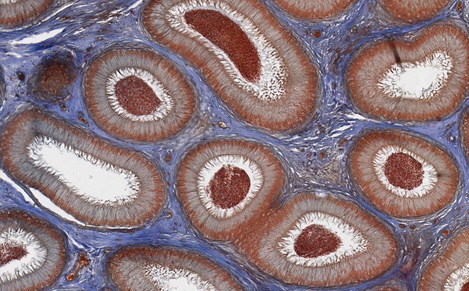 <p>E. Below the basement membrane of the epithelium lie myofibroblasts or smooth muscle cells.</p>