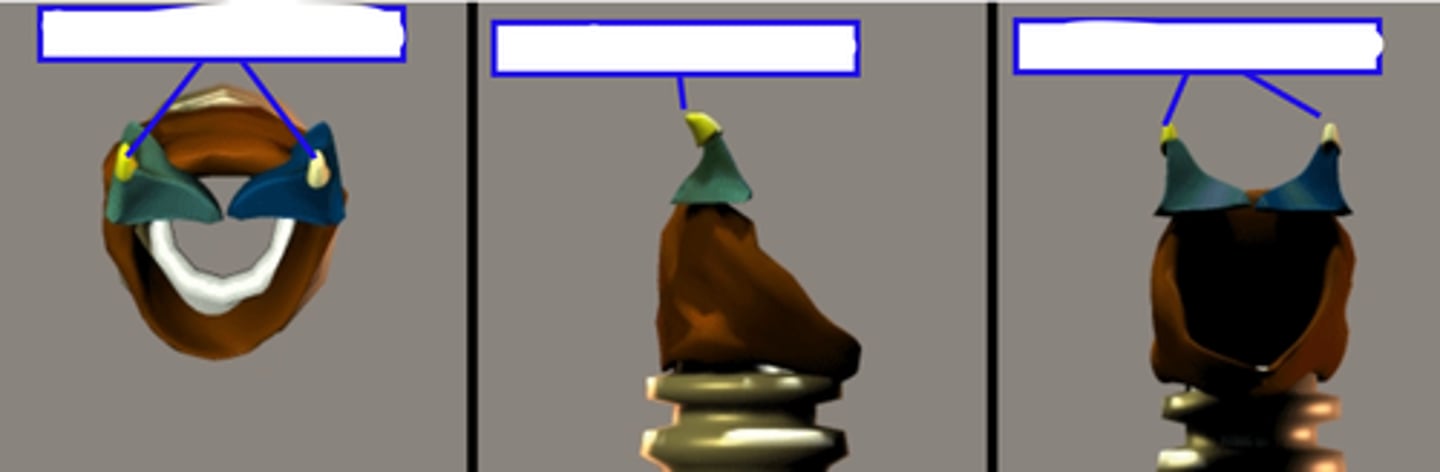 <p>horn like cartilage - behave as part of the arytenoids with no real independent movement</p>