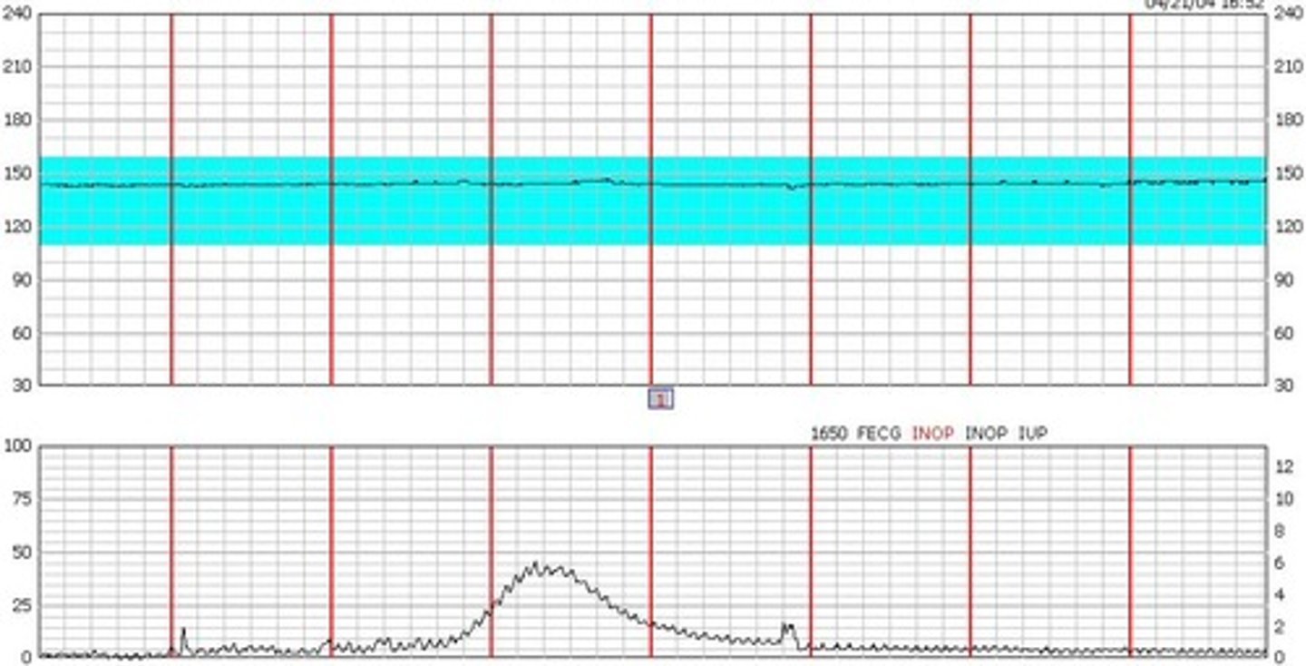 <p>How would you classify this variability?</p>