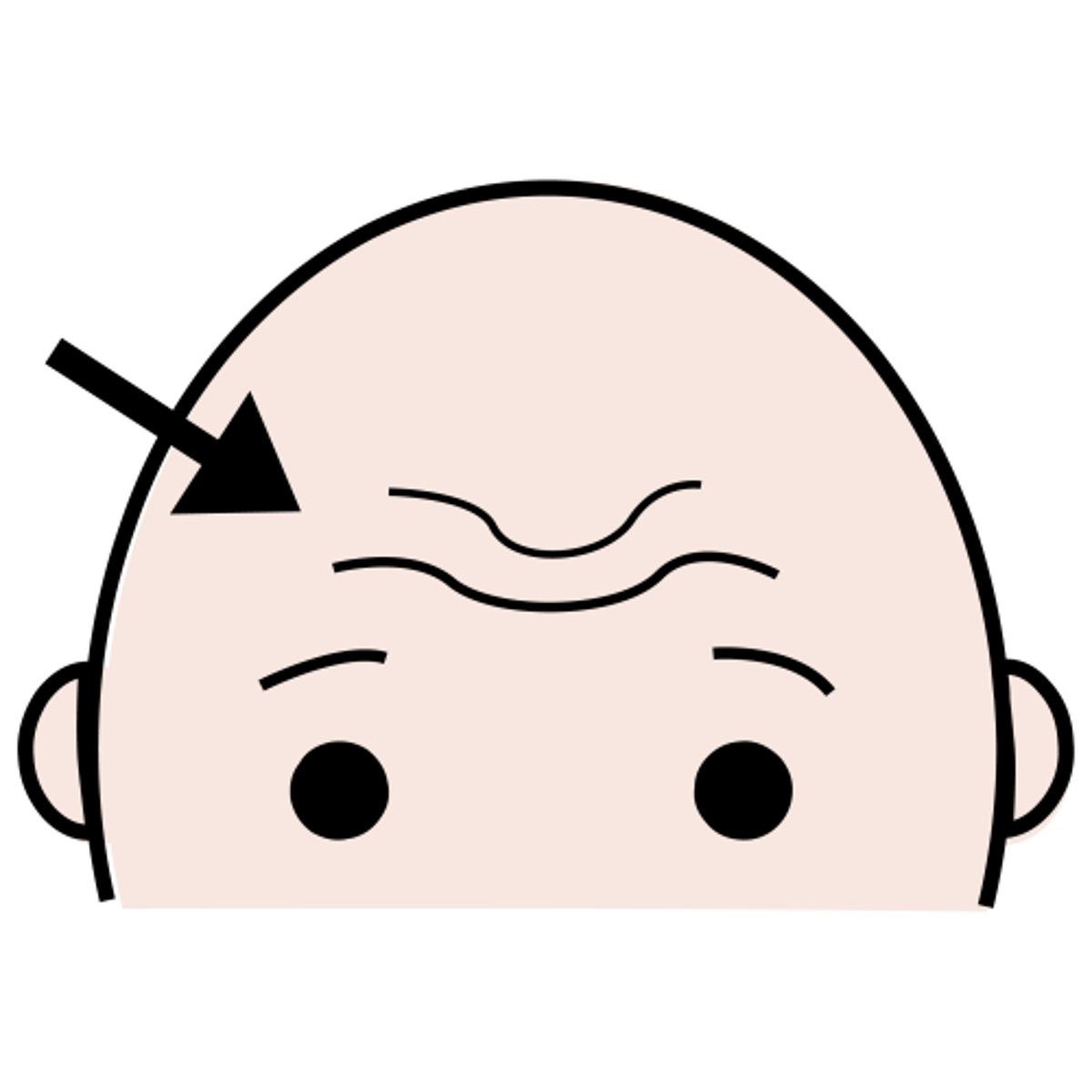 <p>forehead</p>