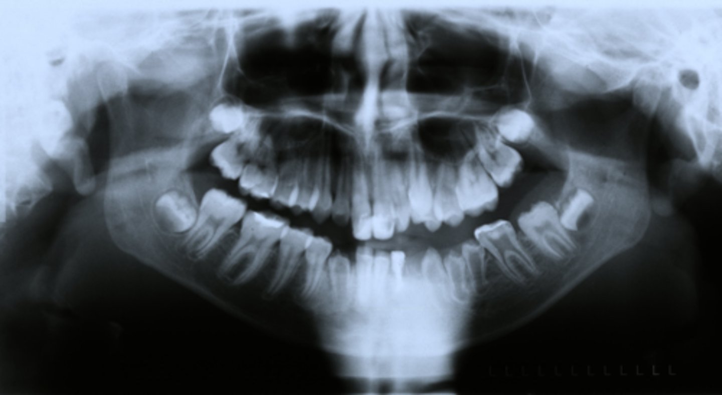 <p>Regional odontodysplasia can cause what type of problems?</p>