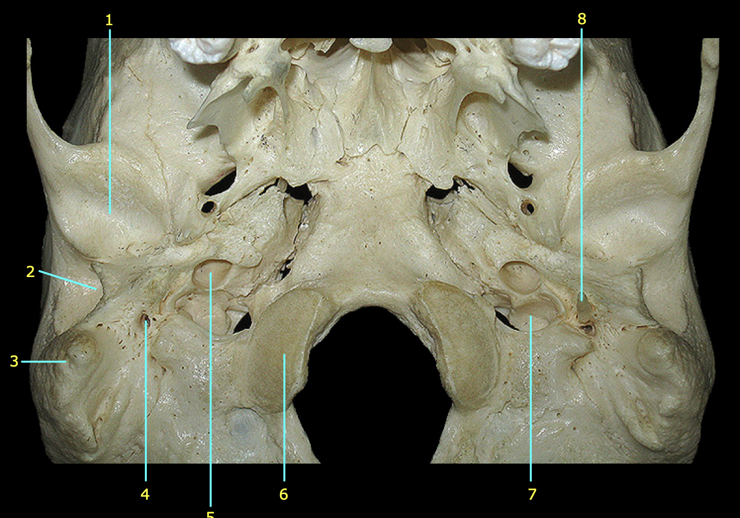 <p>What bone is further examined? What structure is 3?</p>