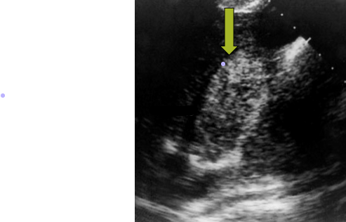 <p>What is this yellow arrow pointing to?</p>