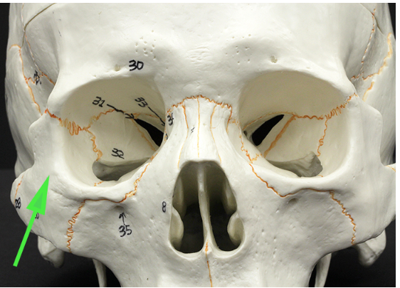 <p>What is the bone indicated by the green arrow?</p>