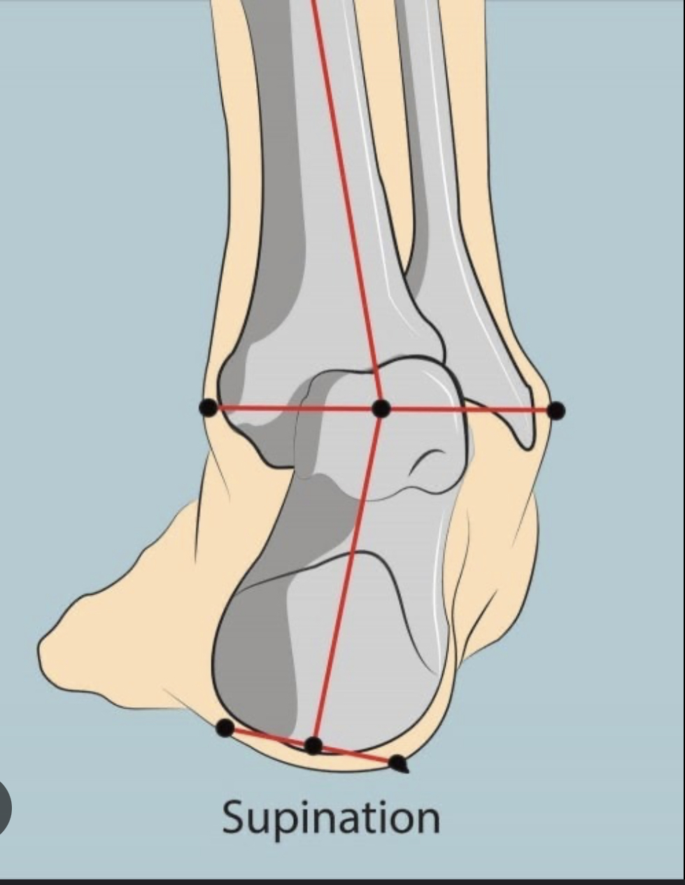 Outward rolling of the foot

\
