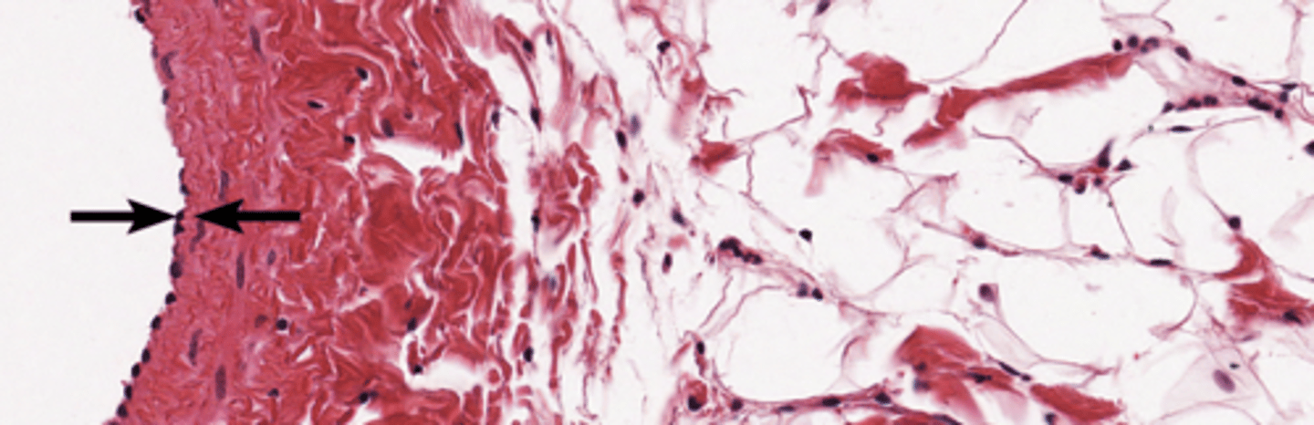 <p>inner layer of vein</p>