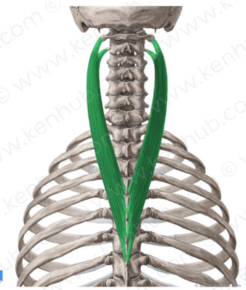 <p>Welke spier is dit?</p>