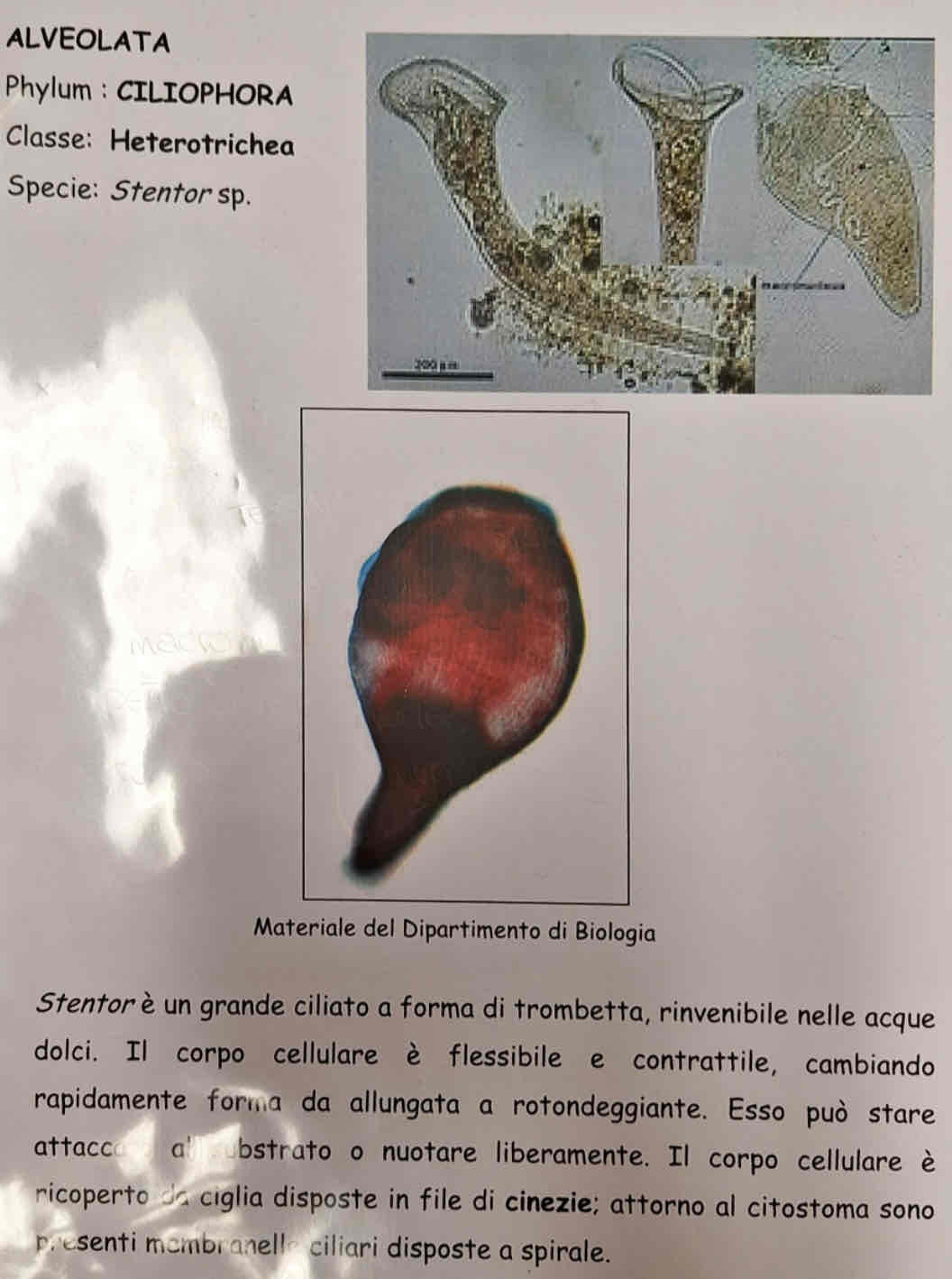 <p><em>Stentor sp</em>.</p>