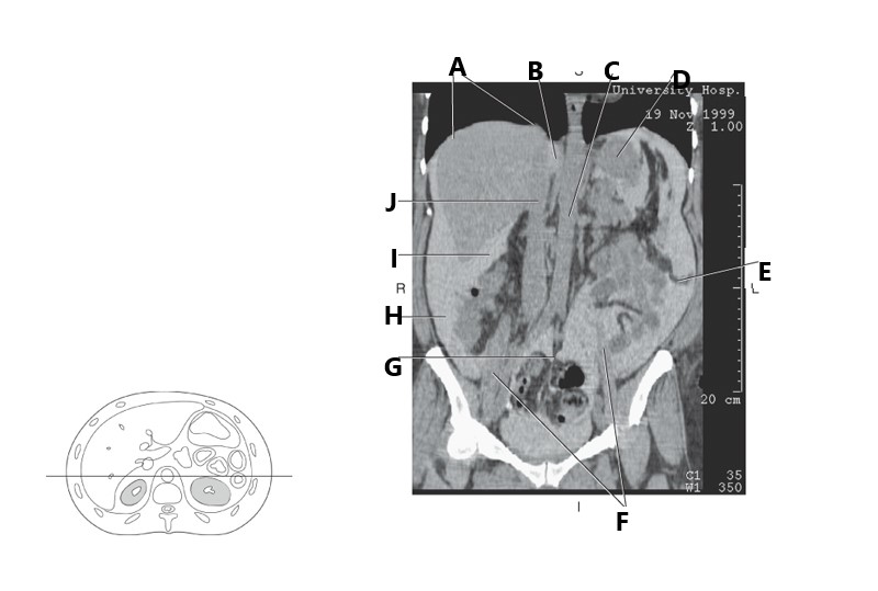 <p>Mesentery</p>