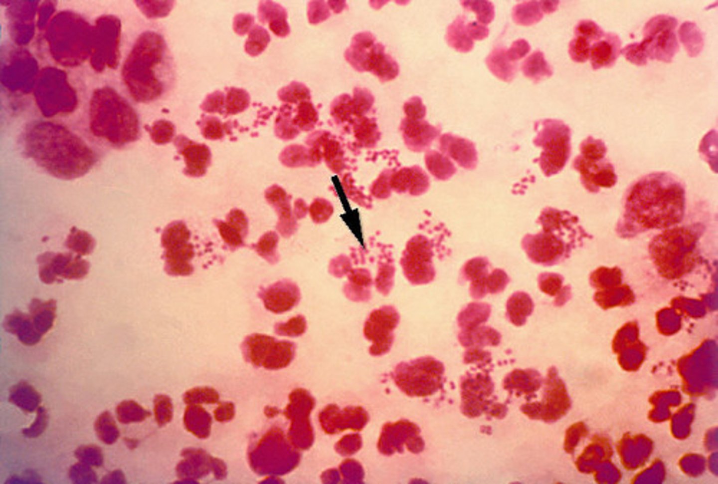 <p>gram negative diplococci intracellular</p>